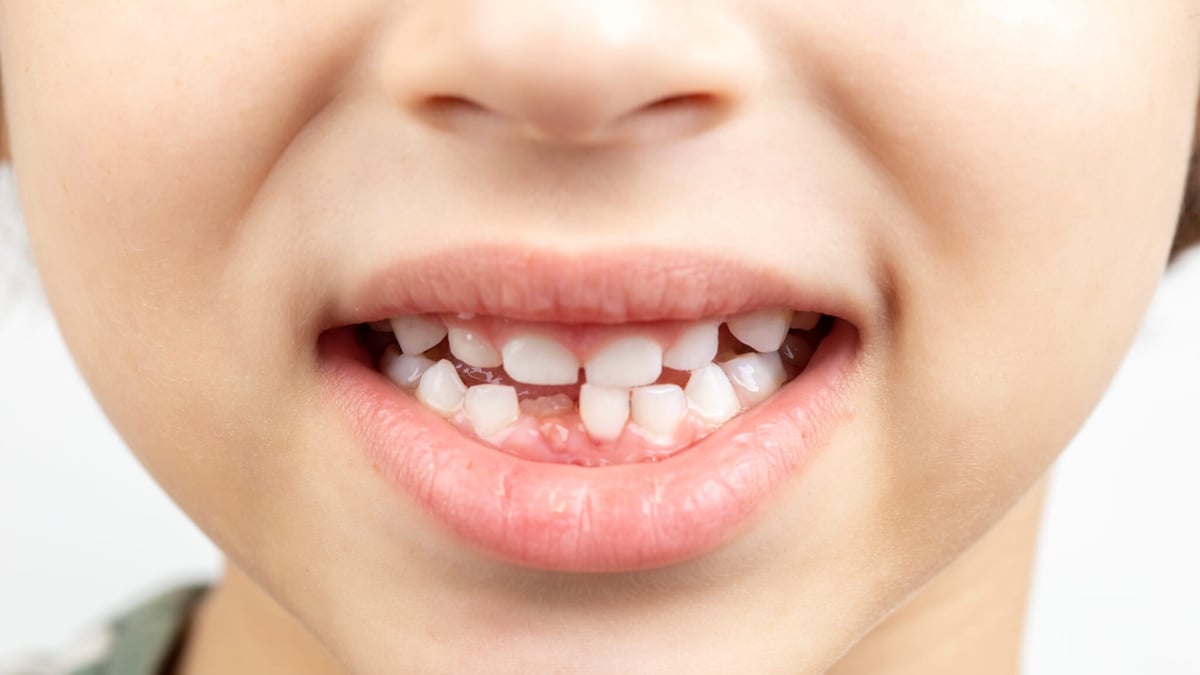 National Children’s Dental Health Month (February 2025) Days Of The Year